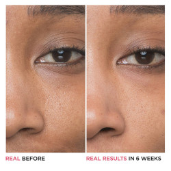 Bye Bye Pores - Siero...